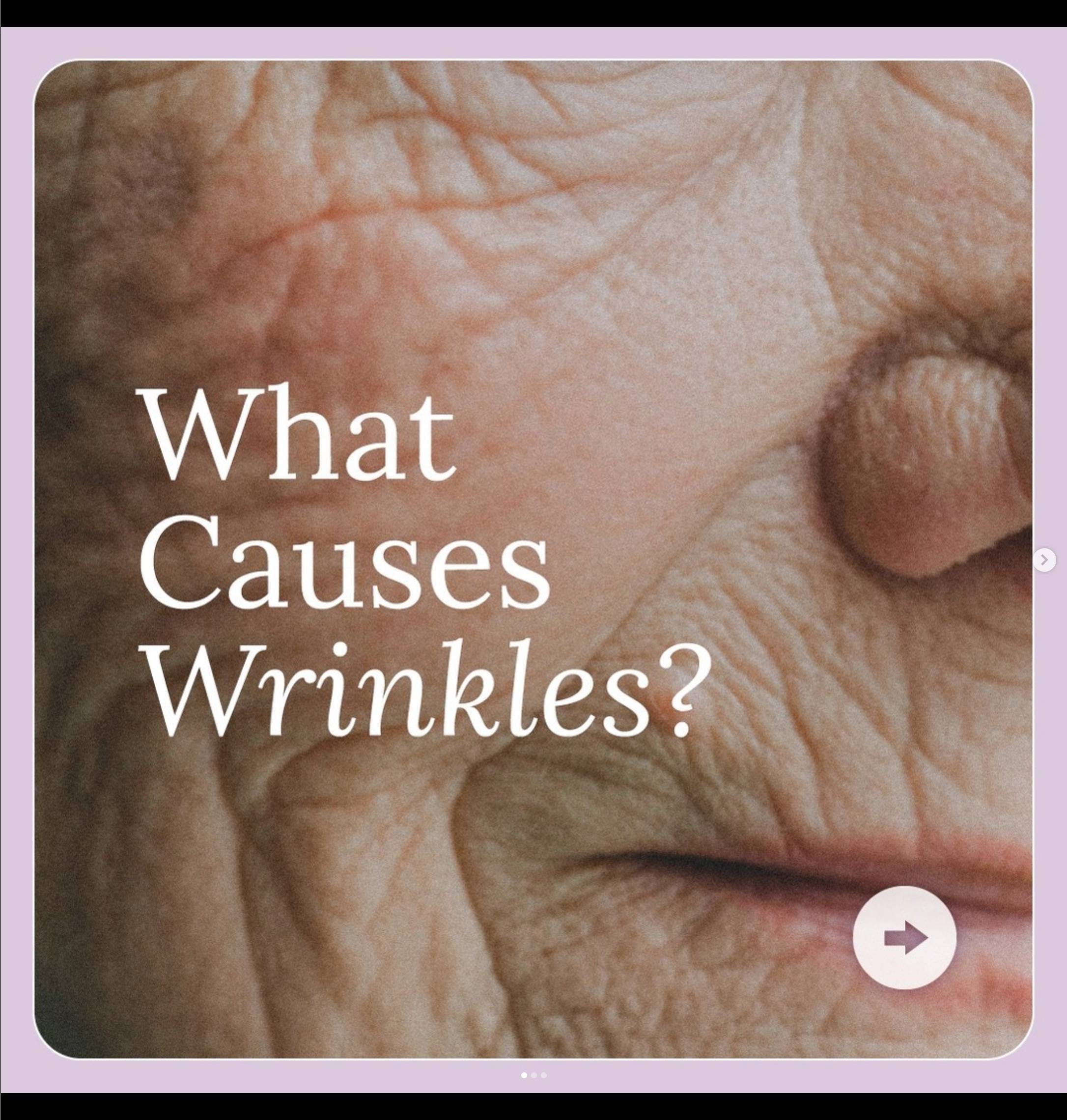 Wrinkles The Facts